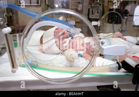 Frühgeborene in einem Intensivbrutschrank in einem NHS-Krankenhaus, England, Großbritannien. Stockfoto