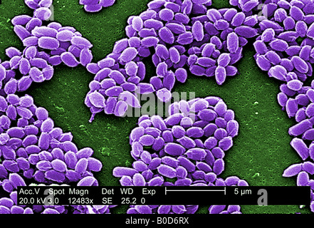 Vergrößerung der 12 483 X SEM Sporen aus die Sterne Bakterienstamm Bacillus anthracis Stockfoto