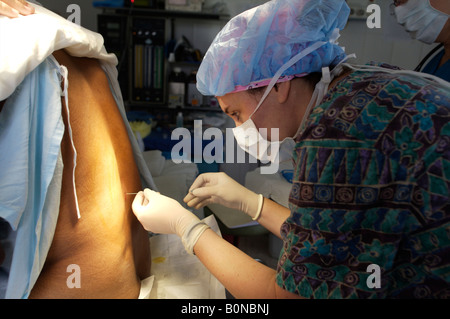 Eine Krankenschwester Anästhesisten verwaltet eine spinale Injektion während der Vorbereitung eines Patienten für die Operation während einer 2006 chirurgischen Mission nach Sula Stockfoto