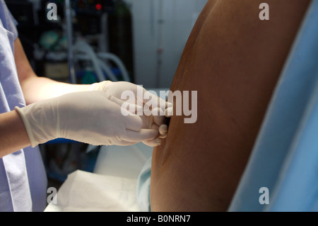 Eine Krankenschwester Anästhesisten verwaltet eine spinale Injektion während der Vorbereitung eines Patienten für die Operation während einer 2006 chirurgischen Mission nach Sula Stockfoto