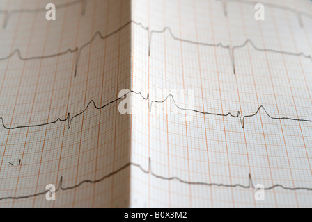 Nahaufnahme von einem EKG Stockfoto