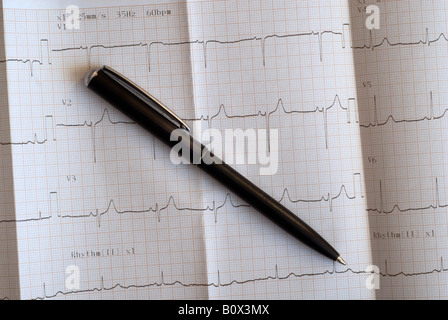 Nahaufnahme eines EKG und einen Stift Stockfoto