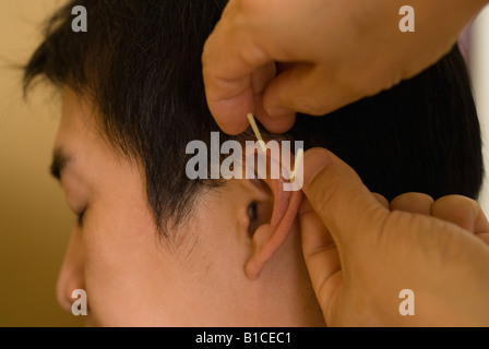 Arzt des Patienten Ohr Akupunkturnadeln aufsetzen Stockfoto