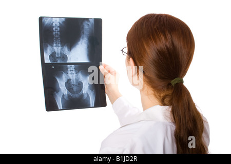 Ärztin untersucht eine Becken-Röntgen Stockfoto