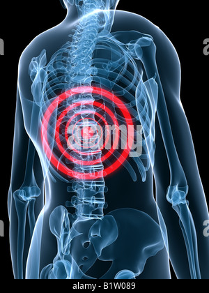 schmerzhafte Wirbelsäule Stockfoto