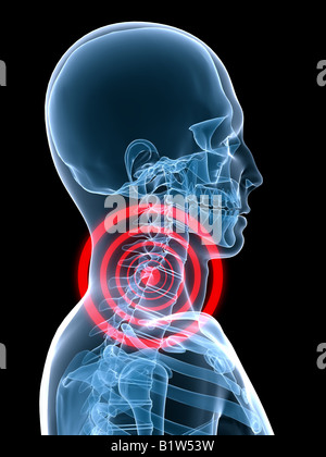 schmerzhafte Wirbelsäule Stockfoto
