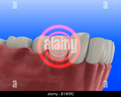 schmerzhaften Zahn Stockfoto