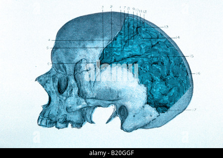 ABBILDUNG SCHÄDEL MIT ZEREBRALE HEMISPHÄRE GEZEIGT Stockfoto