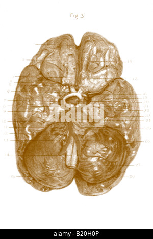 Circulus arteriosus cerebri Stockfotografie - Alamy