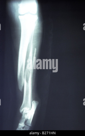 X-RAY HUNDEKNOCHEN S BEIN GEBROCHEN Stockfoto
