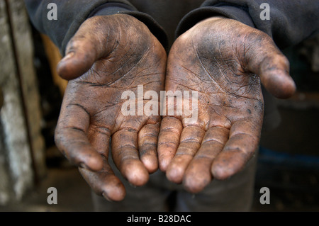 Diese Hände gehören ein 13 Jahre alter Junge arbeitet jeden Tag im Auto Reparatur statt, seine blinde Mutter zu unterstützen. Stockfoto