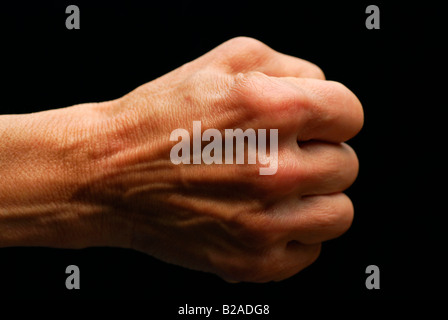 59-j hrige Frauenhand, Symptome von arthritis Stockfoto