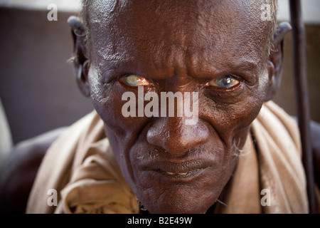 Ein Mann, der an die Auswirkungen der Trachom wartet draußen eine ländliche Regierung Gesundheitsklinik in der Afar-Region Äthiopiens. Stockfoto
