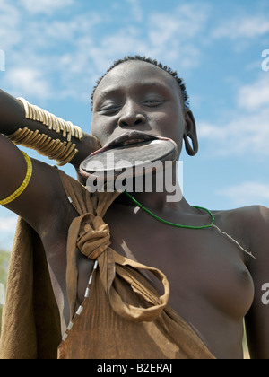 Eine Mursi-Frau trägt einen großen Ton Mundlochplatte. Kurz vor der Ehe wird ein Mädchen Unterlippe durchbohrt und gedehnt werden. Stockfoto