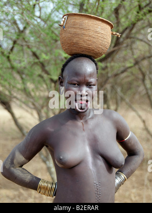 Die gestreckte Unterlippe dieser Mursi-Frau ist unansehnlich, wenn sie ihre großen Ton Mundlochplatte herausnimmt. Stockfoto