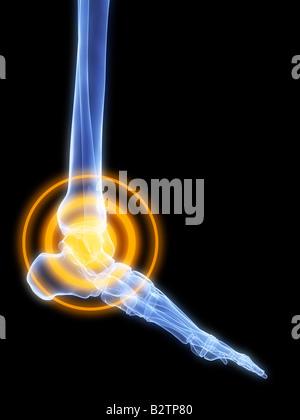 Schmerzen im Sprunggelenk Stockfoto