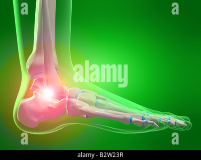 Schmerzen im Sprunggelenk Stockfoto