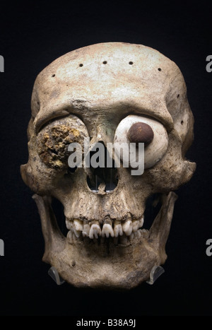 Späten Postklassik Periode aztekischer Skull Maske aus dem Templo Mayor-Museum in Mexiko-Stadt. Stockfoto