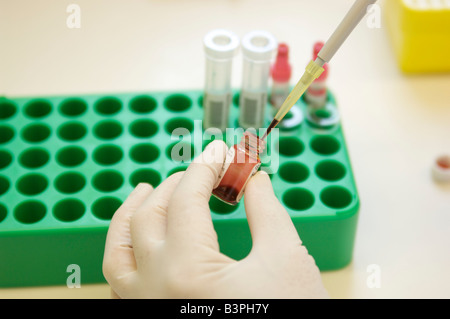 Geben Sie einen sterilen Handschuh Pipettieren mit einer Pipette in einem Labor Stockfoto