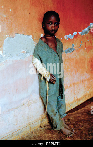 BURUNDIS ETHNISCHE KONFLIKTE ", NOVEMBER 1993.  KERIMBA KRANKENHAUS, BUWERU PROVINZ. VERLETZTE KIND Stockfoto