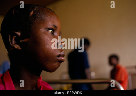 BURUNDIS ETHNISCHE KONFLIKTE ", NOVEMBER 1993.  MÄDCHEN JUNGEN TUTSI IM KIRUNDO KRANKENHAUS MACHETE WUNDEN LEIDEN Stockfoto