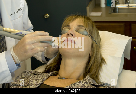 Eine Frau erhält eine Laser-Behandlung, um Hautunreinheiten zu entfernen. Stockfoto