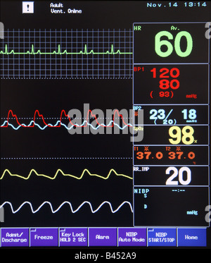 Ein medizinischer monitor Stockfoto