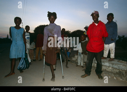 Opfer des Bürgerkrieges in Angola. Stockfoto