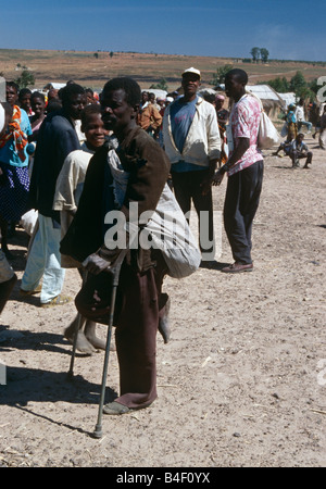 Ein Opfer des Bürgerkrieges in einem Lager für Vertriebene in Angola. Stockfoto