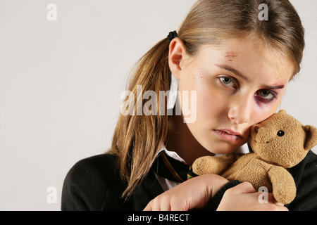 "Schulmädchen mit einem blauen Auge und Gesichtsverletzungen industrieübergreifend Modell Charley Special Effects make up von Rebecca Forshaw" Stockfoto