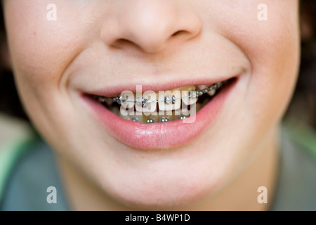 Mund mit Klammer schließen Stockfoto