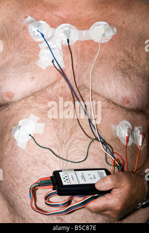 Patient trägt eine 24-Stunden Holter Recorder überwacht Dies ist für die kontinuierliche Aufnahme von einem Patienten EKG oder Herzen Rhythmen verwendet. Model Released Stockfoto