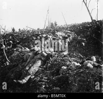 9FK 1915 4 0 A1 3 E Schlacht bei Eparges Franch Gegenangriff Übersetzung Krieg I Western Front Schlacht von Les Eparges Dep Maas 18 km Southw Stockfoto