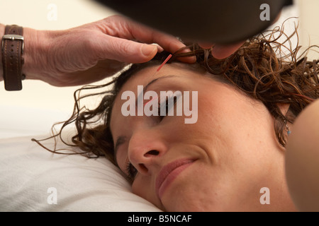 Akupunkturnadeln auf das Gesicht einer erwachsenen Frau Ende der zwanziger Jahre angewendet wird Stockfoto