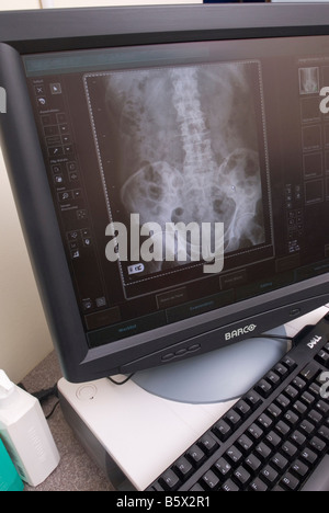 Eine MTRA verwendet einen Computer um zu betrachten, ein Xray in einem Krankenhaus Stockfoto