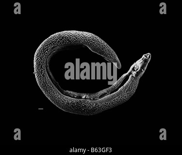 Elektron Schliffbild von einen erwachsenen männlichen Schistosoma Parasit Wurm Stockfoto