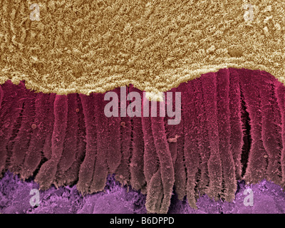 Gallengang, farbige scanning Electron Schliffbild (SEM) Stockfoto