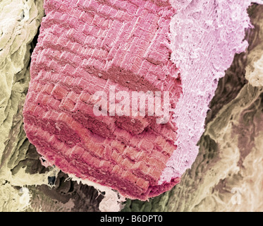 Skelettartiger Muskelfasern, farbige scanning Electron Schliffbild (SEM). Endomysium Bindegewebe ist gelb. Stockfoto