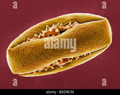 Rosskastanie Pollenkorn. Farbige Scanningelectron Schliffbild (SEM) von ein Pollenkorn aus einem Blütenbaum Rosskastanie. Stockfoto