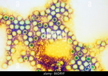 Caliciviruses. Übertragung Electronmicrograph (TEM) von feline Caliciviruses (FCV) gefärbt. Stockfoto