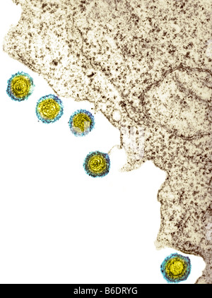 Herpes-Virus-Partikel, farbige Transmissionelectron Schliffbild (TEM). Stockfoto