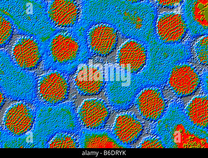 Adenoviren. Übertragung Electronmicrograph (TEM) Adenoviren Partikel gefärbt. Stockfoto