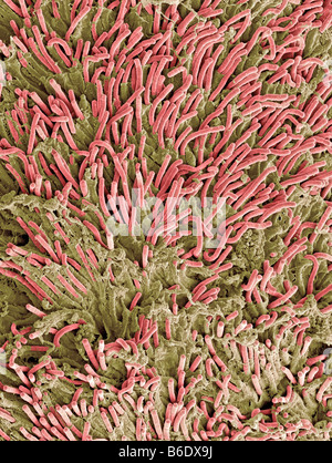 Zahnbelag, farbigen Scan Electronmicrograph (SEM). Zahnbelag besteht aus einem Film Ofbacteria. Stockfoto