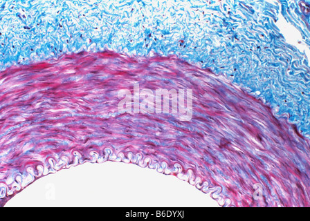 Muskuläre Arterie, leichte Schliffbild einen Querschnitt durch die Wand einer muskulären Arterie. Stockfoto
