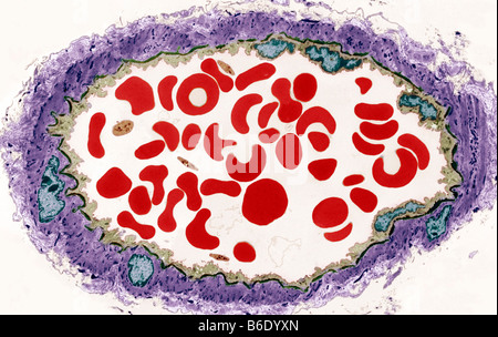 Arterie, farbige Übertragung Elektronen Schliffbild (TEM) von einem Querschnitt durch eine Arterie Stockfoto