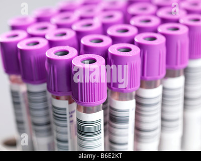 Blutproben. Vacutainer Röhrchen mit Blutproben und mit Barcodes versehen. Stockfoto