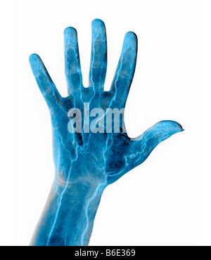 Hand-Blut-Versorgungsmaterial Stockfoto