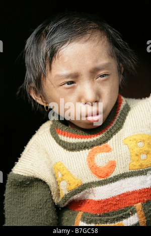 18 Jahre alte Khagendra Thapa Magar die weltweit kleinste Mann Stockfoto