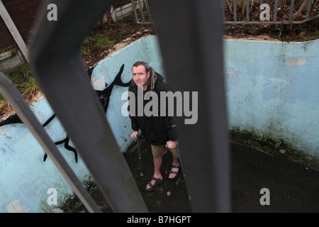 ein Portrait eines Mannes mit einem gebrochenen Knöchel, der seit mehr als 13 Monaten für das n.h.s bedienbar an seinem Knöchel zu reparieren gewartet hat Stockfoto