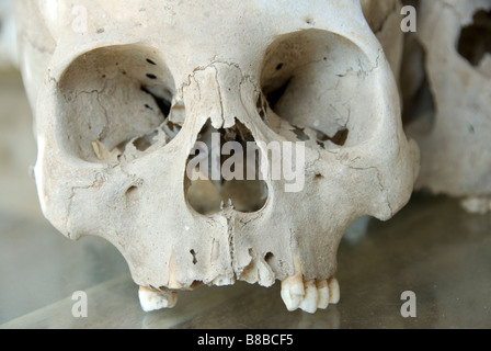 Ein Opfer von Pol Pot und der maoistischen Regime, Choeung Ek Tötung Felder Kambodscha Stockfoto